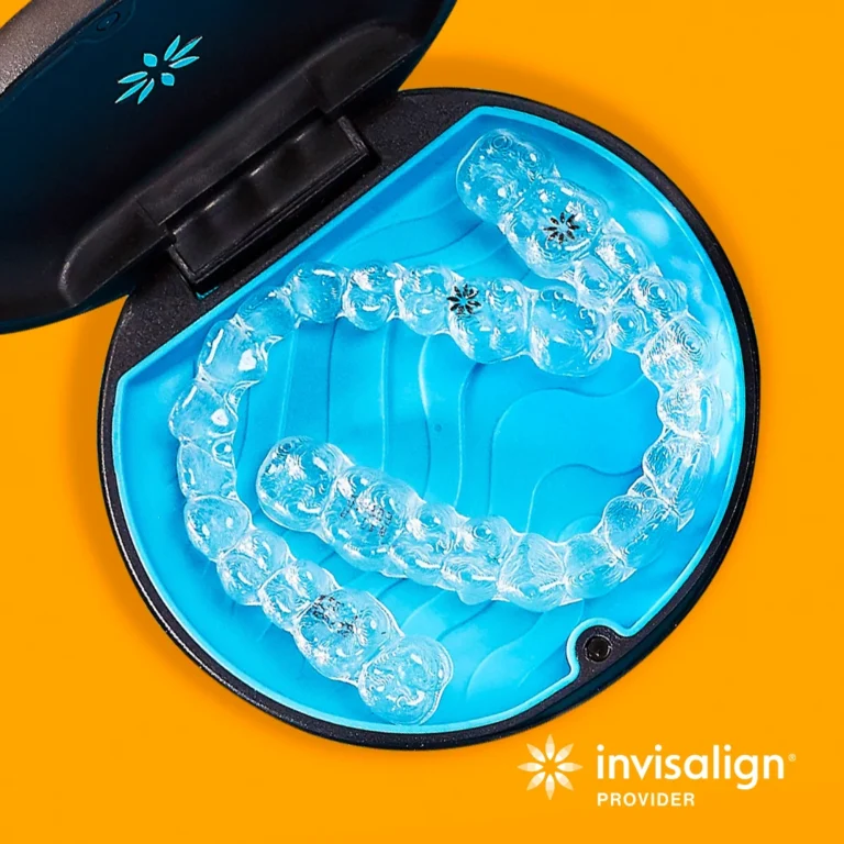 Transparent teeth aligners