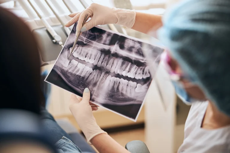 Dental X-ray scan review