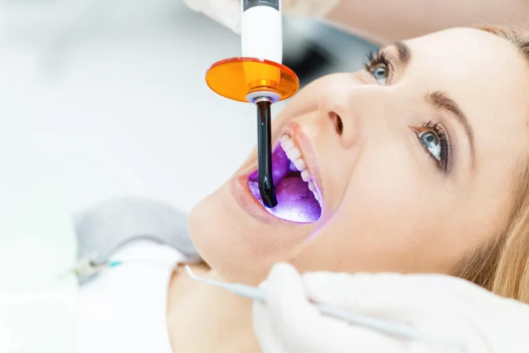 Tooth filling curing process
