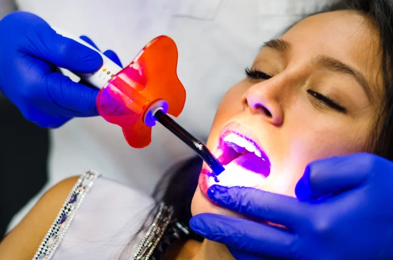 Cavity prevention curing light