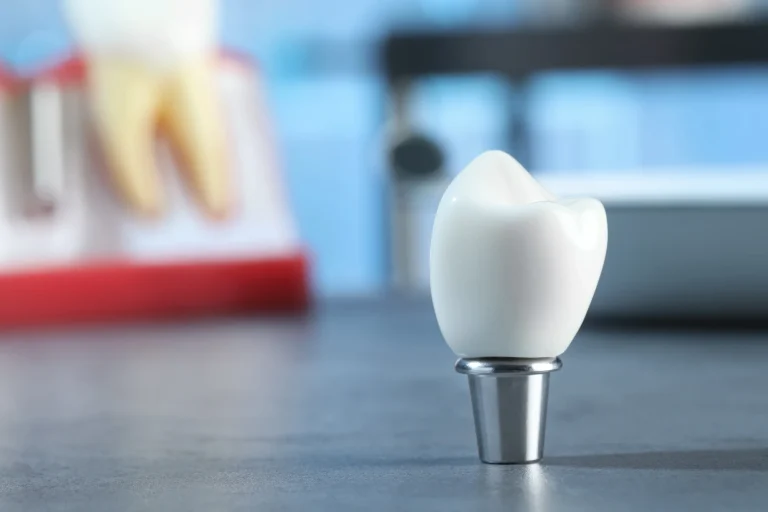 Crown implant abutment display