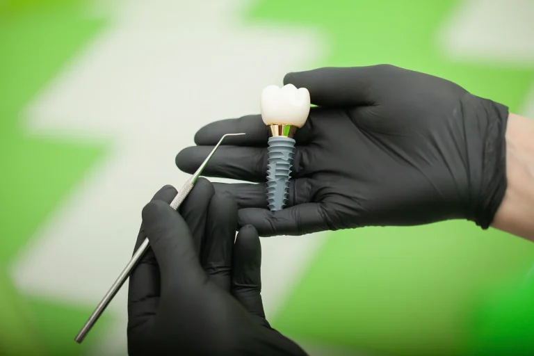 Dental implant placement procedure