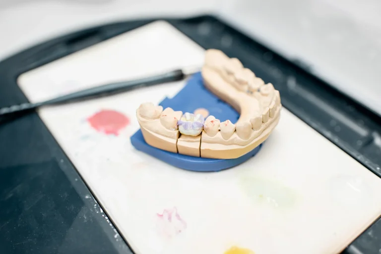 Crown bridge treatment model