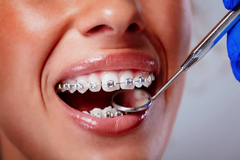 Orthodontic treatment inspection