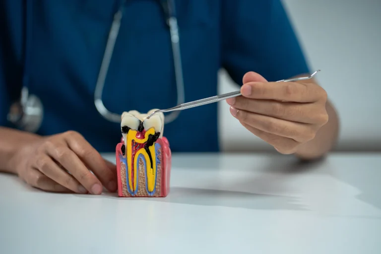 Root canal treatment model