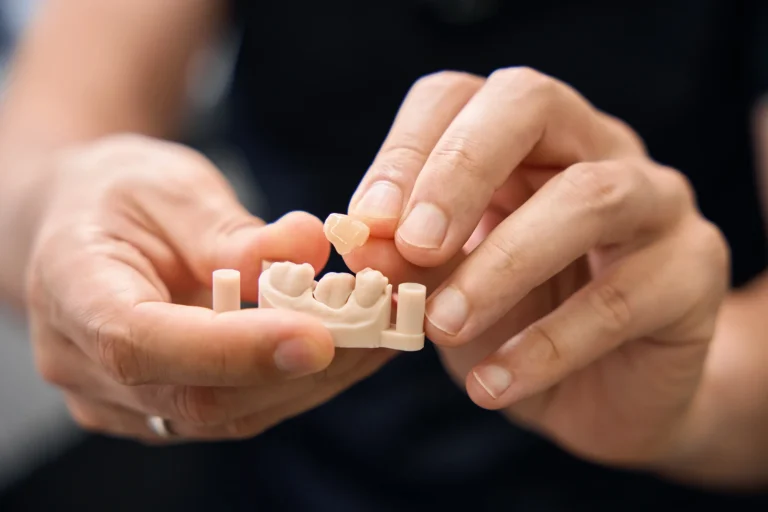 Restorative dental model hands