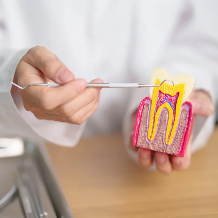 Endodontic treatment illustration