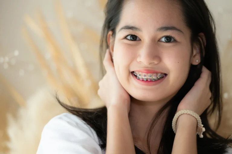 Clear braces dental alignment