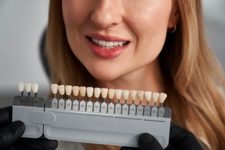 Cosmetic veneer consultation