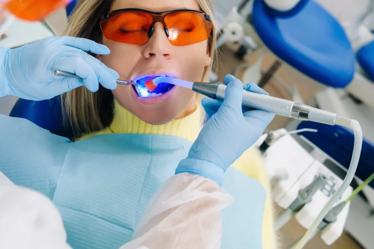Dental bonding treatment procedure
