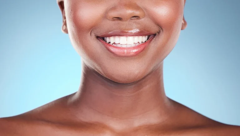 Cosmetic dental whitening